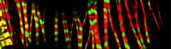 Muscle actin myosin